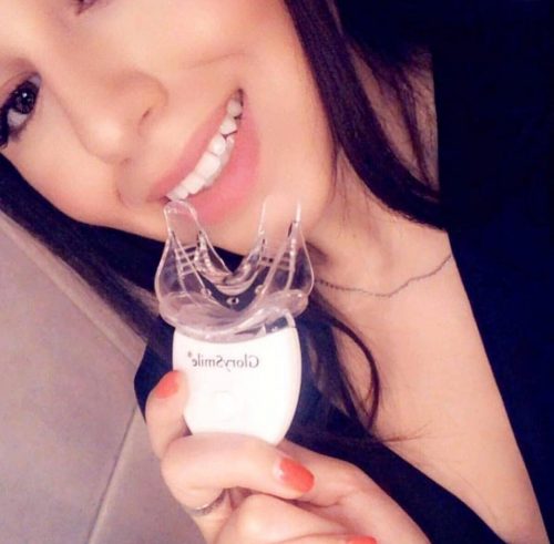 ΚΙΤ ΛΕΥΚΑΝΣΗΣ ΔΟΝΤΙΩΝ GLORYSMILE ΛΕΥΚΑΝΣΗ ΔΟΝΤΙΩΝ