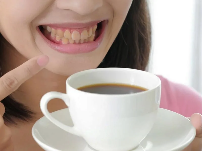 ΤΑΙΝΙΕΣ ΛΕΥΚΑΝΣΗΣ ΔΟΝΤΙΩΝ - GLORY SMILE TEETH WHITENING