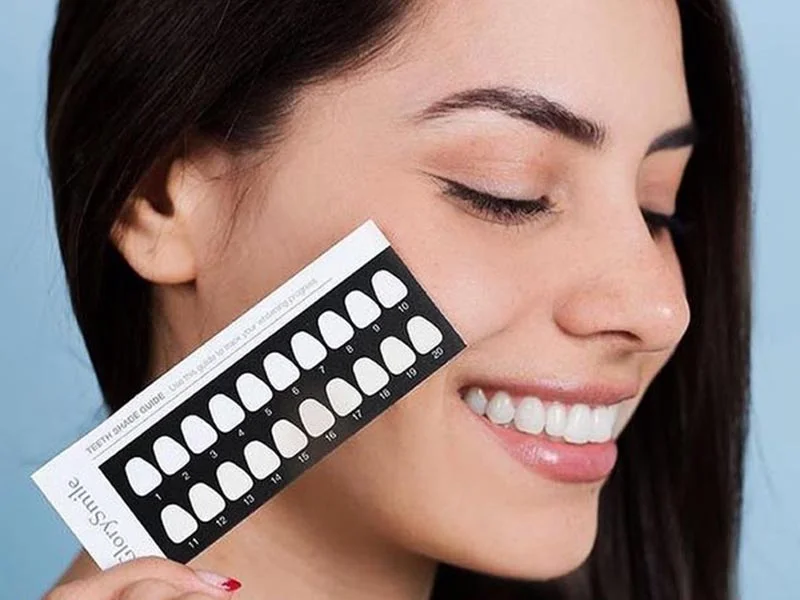 ΤΑΙΝΙΕΣ ΛΕΥΚΑΝΣΗΣ ΔΟΝΤΙΩΝ - GLORY SMILE TEETH WHITENING